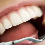 Le controindicazioni all'implantologia dentale