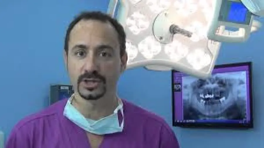 Materiali di qualità e staff preparato per un impianto dentale da numeri 1