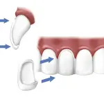 Come avere un nuovo sorriso ?
