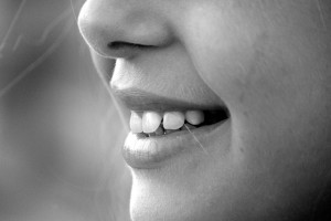 faccette dentali in ceramica a Palermo