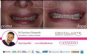 clinica dentale caso clinico